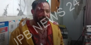 Read more about the article जालंधर पंजाब प्रेस क्लब के सीनियर उप प्रधान राजेश थापा पर हुआ हमला